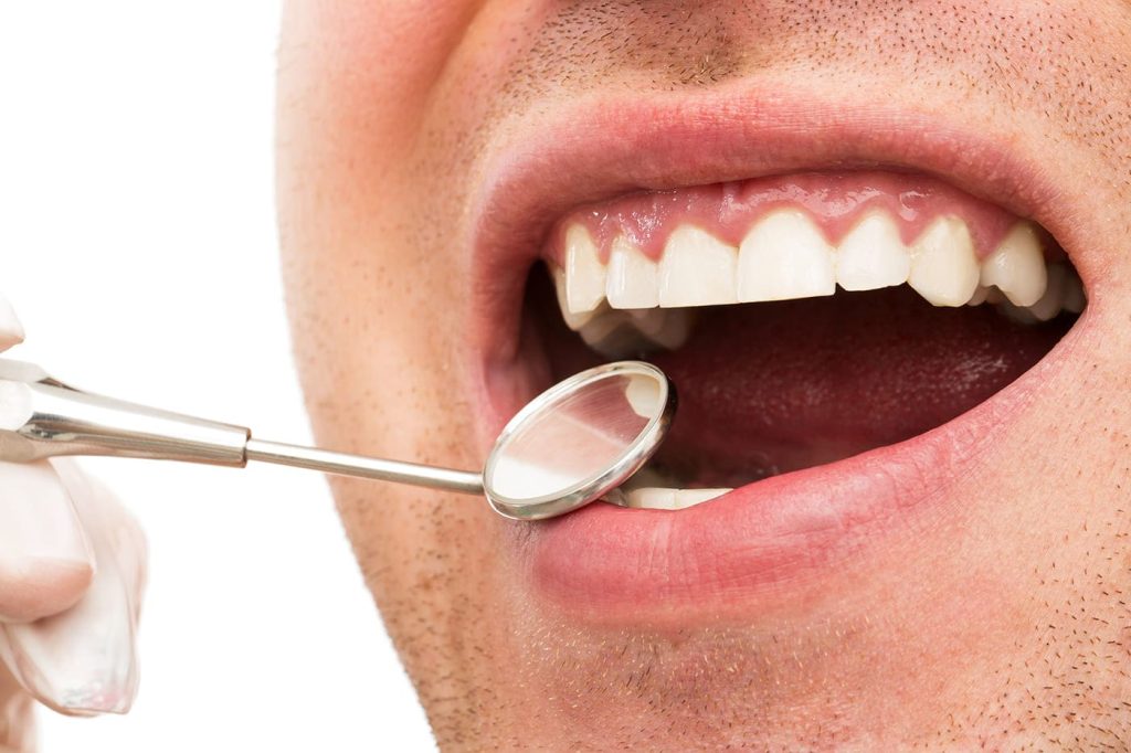 Tratamiento de Periodoncia