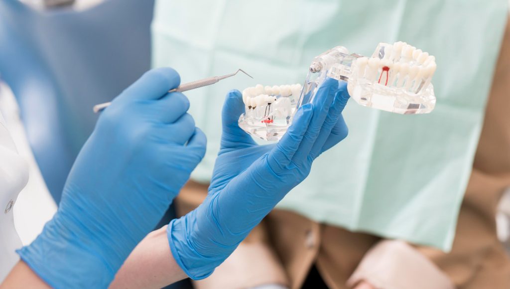 Tratamientos de Endodoncia en Las Palmas